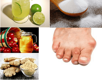 نقرس و رژیم بیماران مبتلا به آن