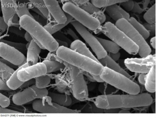 از بین بردن هزارپاهای مضر