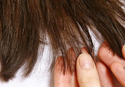 درمان خانگی موخوره