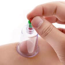 حجامت برای سلامتی مفید است یا مضر؟