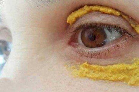 درمان تیرگی دور چشم با زرد چوبه