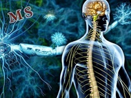 آشنایی با مواد غذایی که به کاهش علائم "ام اس" کمک می‌کند