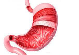 داروهاي خانگي براي زخم معده