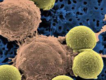 چطور سيستم ايمني بدنتان را تقويت کنيد