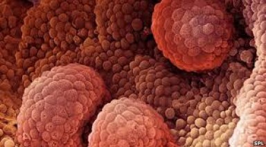 6 گیاه برای پیشگیری از سرطان